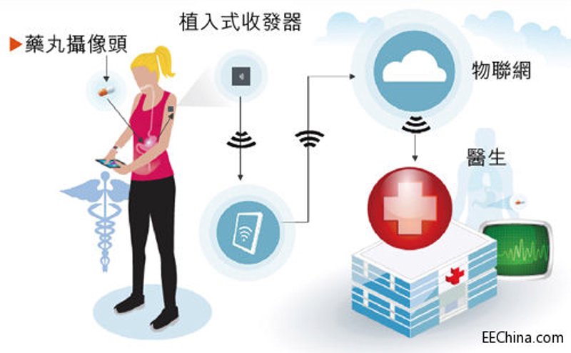 智能护理裤：解决失禁患者的日常难题